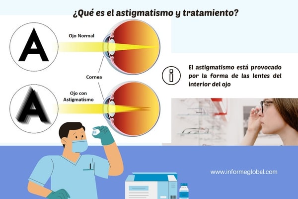 astigmatismo y tratamientos